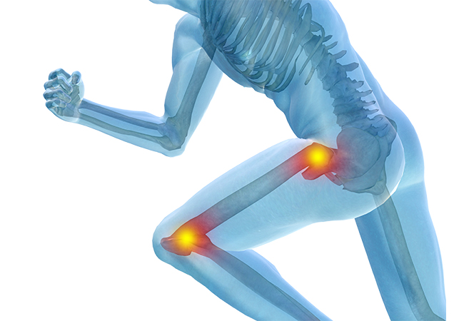 The Connection Between Hip and Knee Pain